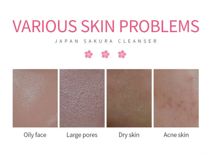 Laikou Sakura Whitening Facial Cleanser Foam Moisturizing Deep Remove Cleansing Acne Milk Oil Control Exfoliating Shrink Pores